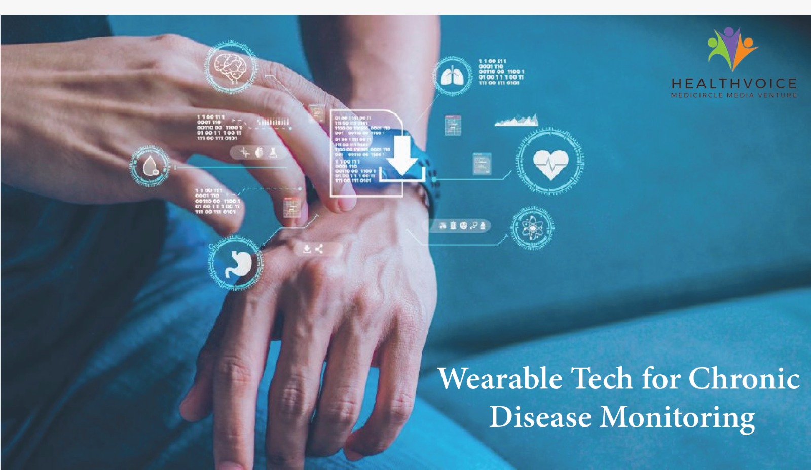 View of Wearable Tech for Chronic Disease Monitoring: